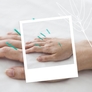 Acupuncture Tools